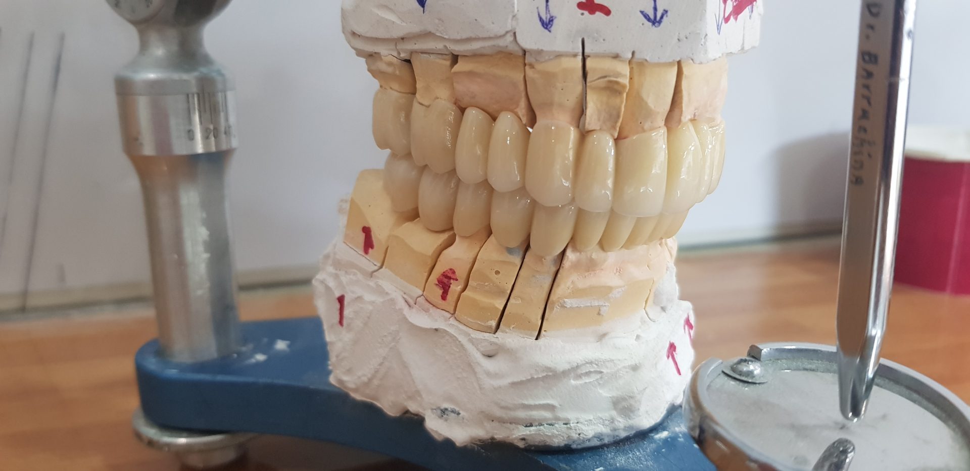 Piezas dentales